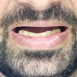 دندانسازی