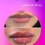 کلینیک لیزر و زیبایی مهسان