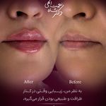 پوست مو فیلر جوانساز دکتر شاه نعمت الهی