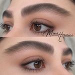 میکروبلیدینگ و شیدینگ مینا حسینی