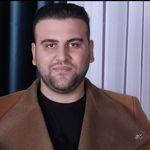 کاشت مو سر و ریش و ابرو بقایی