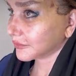کلینیک زیبایی الماس کاملا اقساطی