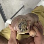 کلینیک درمان زخم و هایپربار