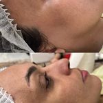 خدمات تخصصي پوست و تيرگي هاي بدن محبوبه
