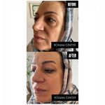 کلینیک پوست مو و زیبایی رکسانا