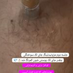 خدمات تخصصی آرایش دائم وریموواستادحمیدی