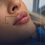 تزریقات زیبایی حدیث