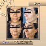 مطب پوست مو زیبایی فردوس شرق