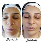خدمات تخصصی پاکسازی پوست و فیشیال مهشید
