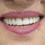 دندانپزشکی الی دنت ‌دیجیتال و اقساطی