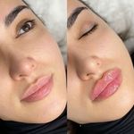 کلینیک پوست و مو و لیزر آتن