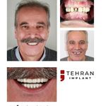 کلینیک تخصصی تهران ایمپلنت