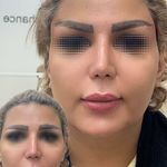 مطب  دکتر ملینا پورکاظمی