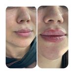 کلینیک لیزر  کندلاوزیبایی پوست ومو آیشیل