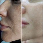 آموزش و خدمات پوست و فیشال رویا باقریان