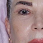 کلینیک زیبایی الماس کاملا اقساطی