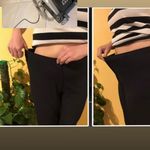 مرکز لیزر ، لاغری و زیبایی لاوین