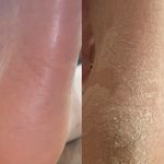 خدمات تخصصی پدیکور پا