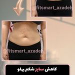 مرکز لاغری موضعی و ایکس بادی فیت اسمارت