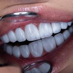 کلینیک طراحی لبخند مایا