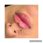 مطب زیبایی دکتر نلسا