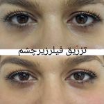 کلینیک پوست و مو و لیزر نیلوفر آبی