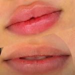 کلینیک پوست مو لیزر و لاغری عصر زیبایی