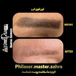 مرکز تخصصی لیزر تتو زهرا کفعمی