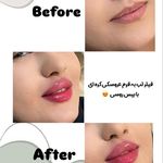 کلینیک پوست و مو و لیزر نیلوفر آبی