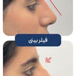 کلینیک زیبایی و جوانسازی پوست و مو الین