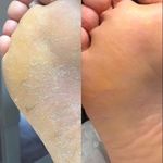 پدیکور و کفسابی پا اذرنوش