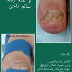 بهناز شب بویی زنجان (با علم پودولوژی) (Ad)
