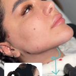 کلینیک تخصصی پوست و زیبایی ملینا