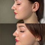 کلینیک پوست و زیبایی ژیلاوَش