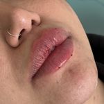 کلینیک زیبایی و لیزر دکتر آزاده اسماعیلی