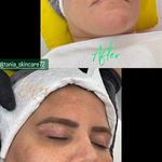 خدمات فیشیال و پاکسازی پوست