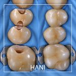 دندانپزشکی دکترخرمشاهی کلینیک دیجیتال