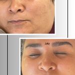 خدمات تخصصی فیشال و پاکسازی پوست صبا