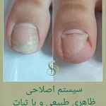 پدیکور و پودولوژیSD