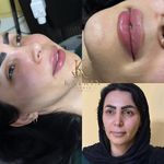 کلینیک زیبایی کاترین