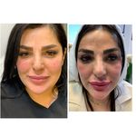 کلینیک زیبایی آفرینش،دکتر مهدی قهرمانیان