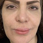 کلینیک زیبایی فامیل امیر