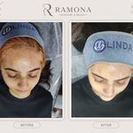 رامونا اسکین کر