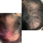 خدمات تخصصی فیشیال آیسو