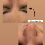 آرایشگاه زنانه إلماه