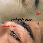 خدمات فیشیال و آموزش تخصصی پوست فروغ