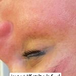 خدمات تخصصی پاکسازی پوست فروغ یزدانی