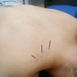 کلینیک فیزیوتراپی تسنیم