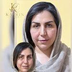 کلینیک زیبایی کاترین
