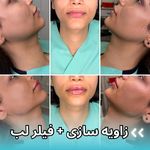 مرکز لیزر و زیبایی آرورا